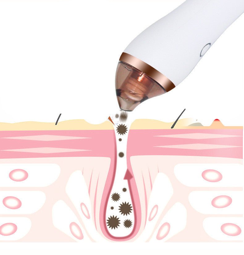 4 in 1 Body Guasha Cupping Blackhead Remover - AmiraMart