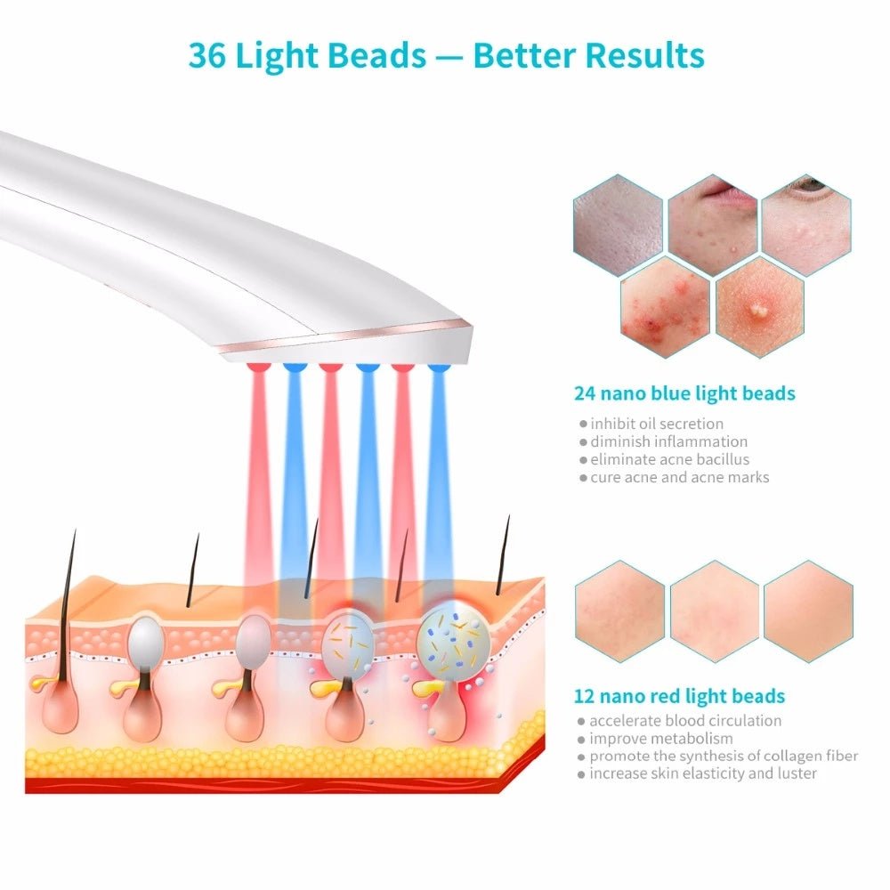 Acne Light Therapy Device – Blue & Red LED Treatment - AmiraMart