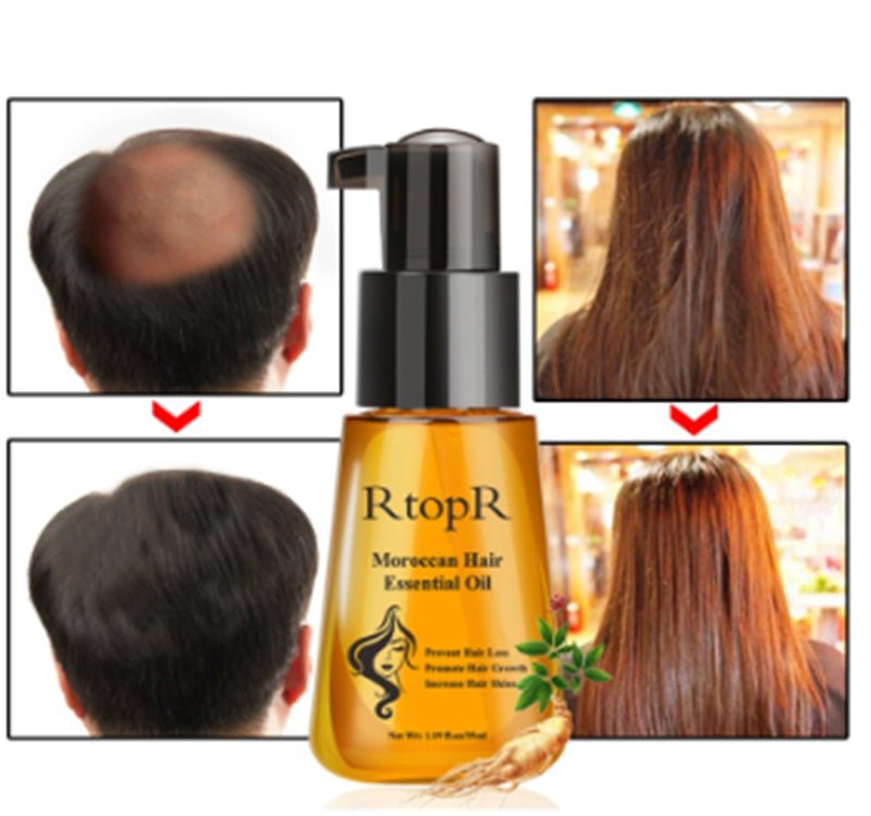 Anti - hair Loss Product Moroccan Hair Essential Oil 35ml - AmiraMart