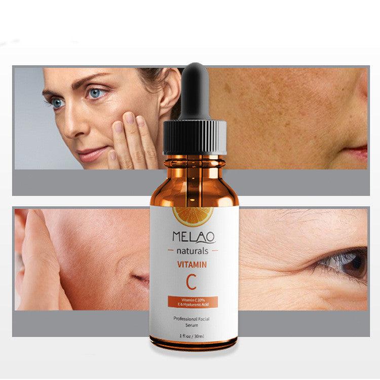 Anti - wrinkle Vitamin C Serum - AmiraMart