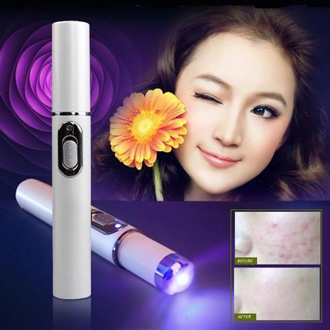 Blue Light Therapy Acne Laser Pen - AmiraMart