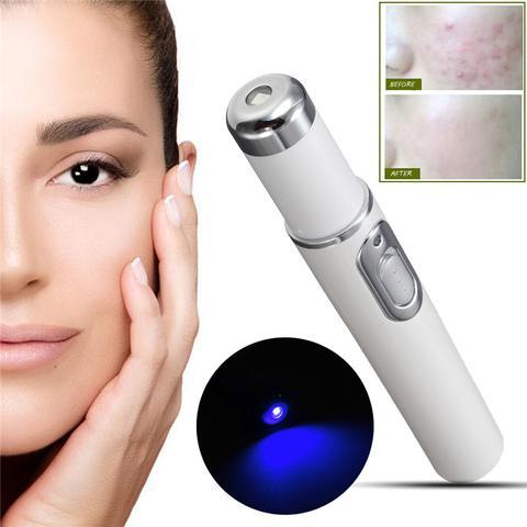 Blue Light Therapy Acne Laser Pen - AmiraMart