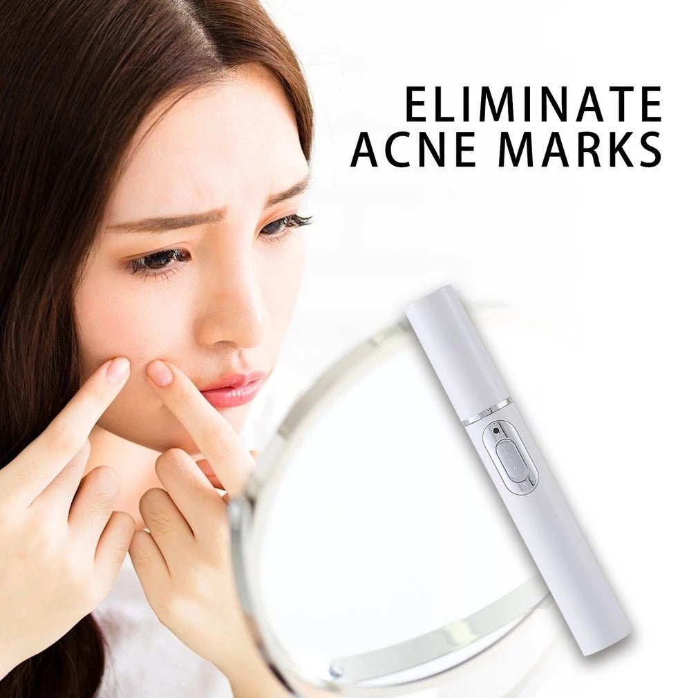 Blue Light Therapy Acne Laser Pen - AmiraMart