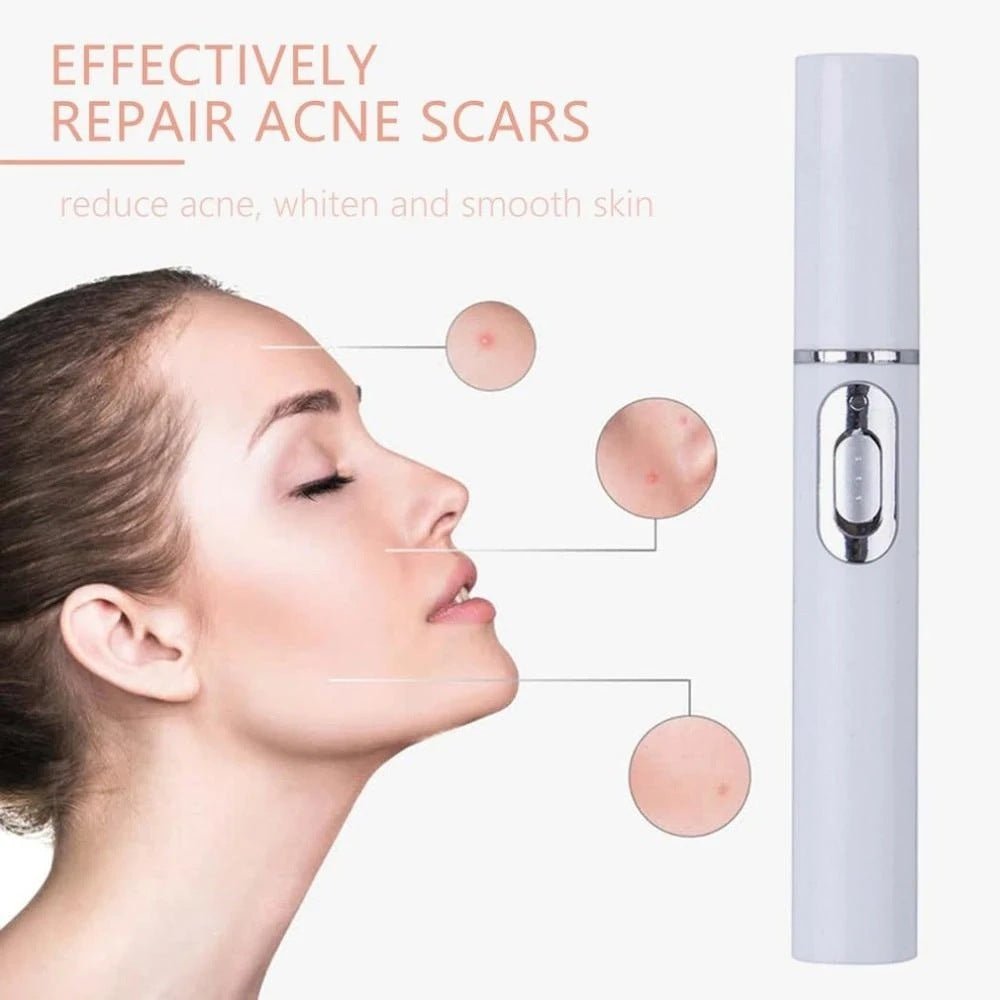 Blue Light Therapy Acne Laser Pen - AmiraMart