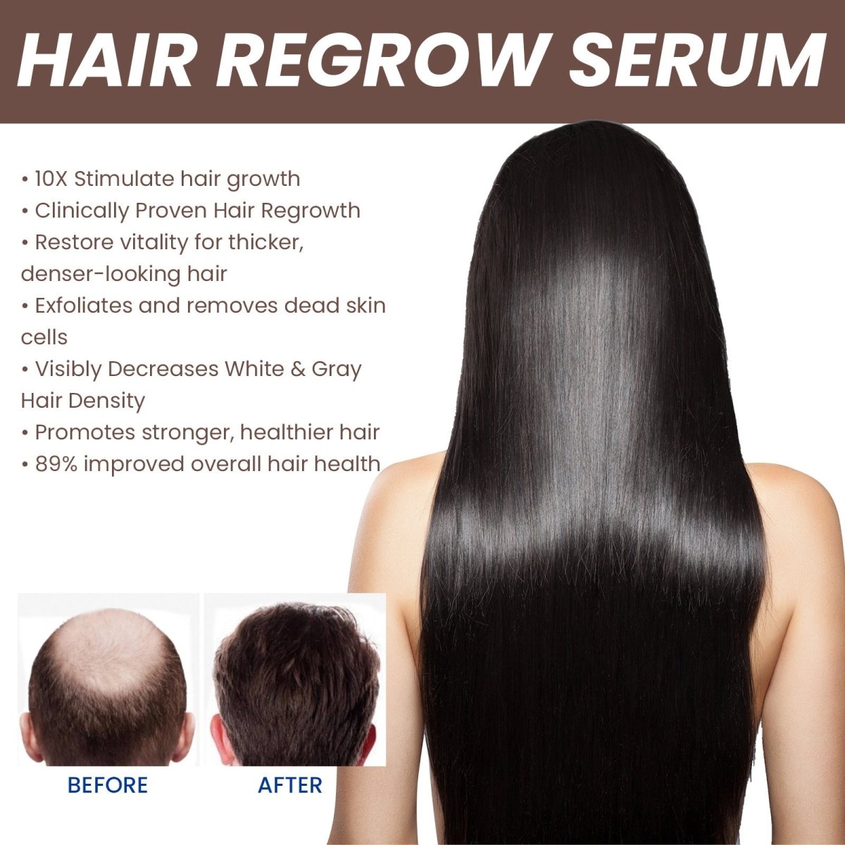 Hair Dense Essence – Anti - Hair Loss & Growth Treatment - AmiraMart