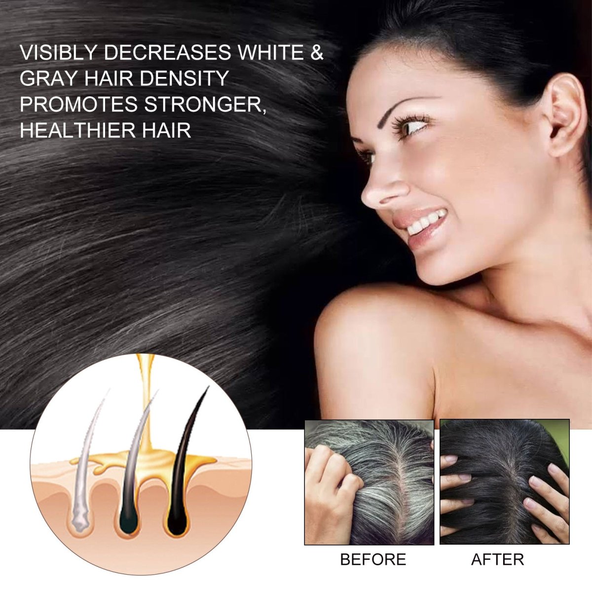 Hair Dense Essence – Anti - Hair Loss & Growth Treatment - AmiraMart