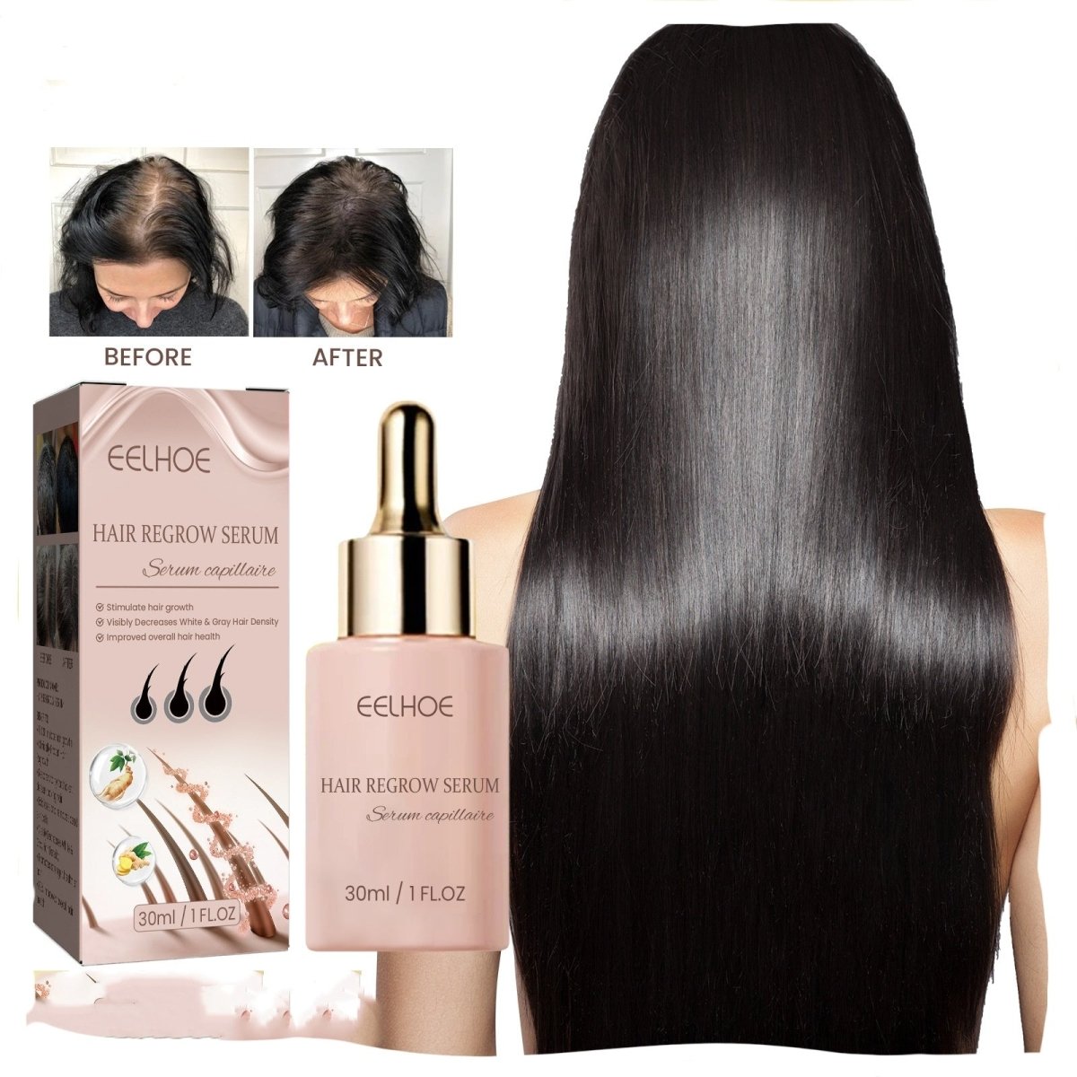 Hair Dense Essence – Anti - Hair Loss & Growth Treatment - AmiraMart