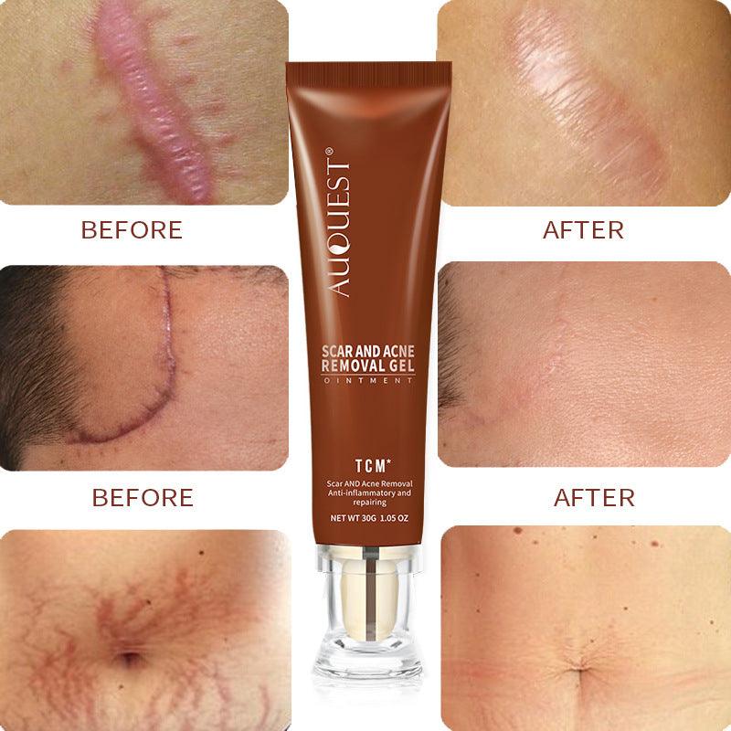 Moisturizing And Repairing Scar Skin Care Cream - AmiraMart