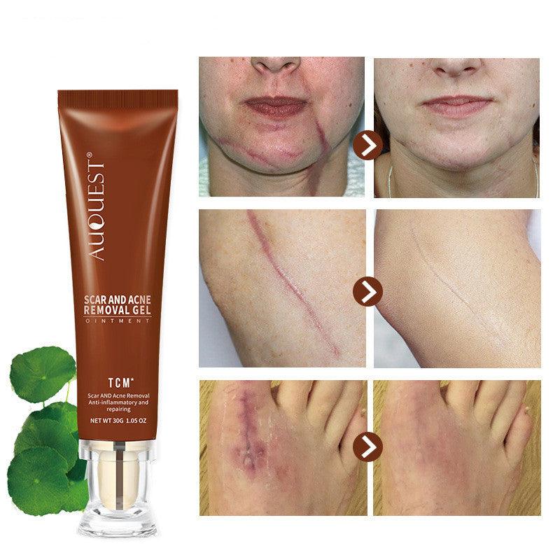 Moisturizing And Repairing Scar Skin Care Cream - AmiraMart