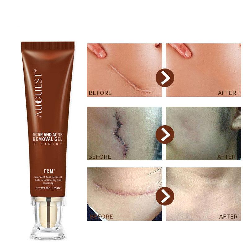 Moisturizing And Repairing Scar Skin Care Cream - AmiraMart