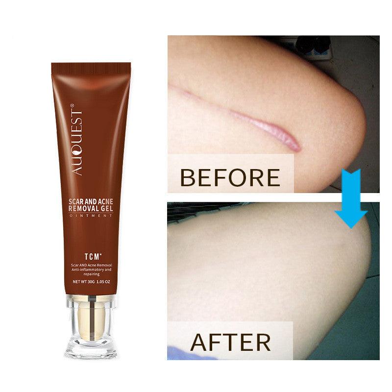 Moisturizing And Repairing Scar Skin Care Cream - AmiraMart
