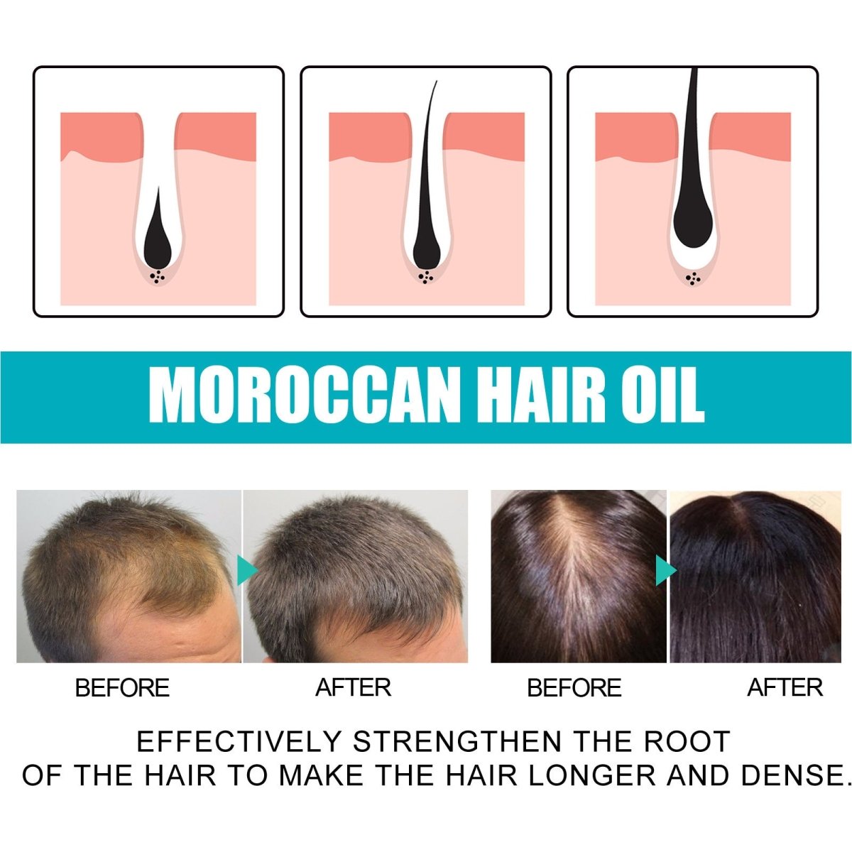 Moroccan Hair Oil – Smooth, Strengthen & Densify Dry Hair - AmiraMart