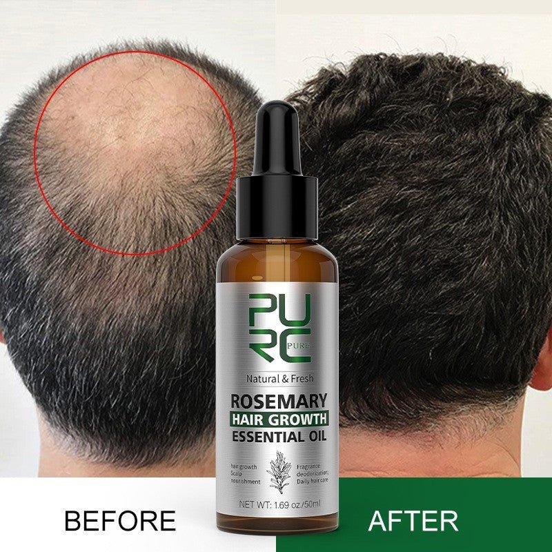 Rosemary & Ginger Hair Oil - AmiraMart