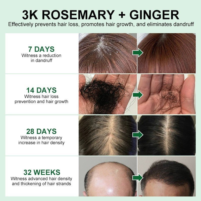Rosemary & Ginger Hair Oil - AmiraMart