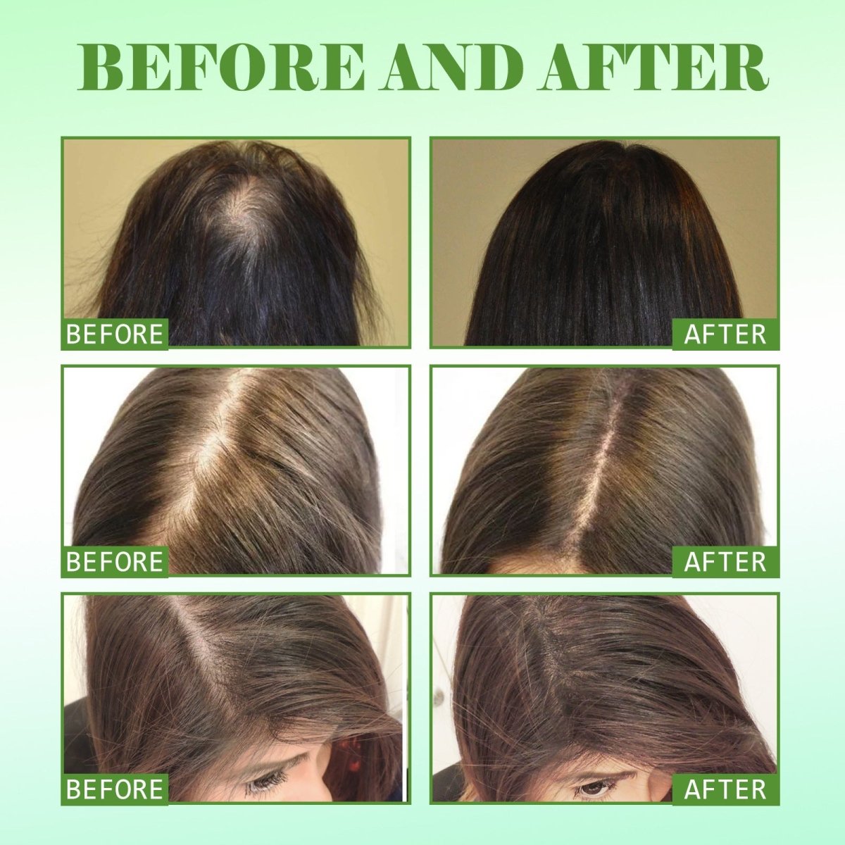 Rosemary Hair Oil – Repair Damage & Boost Growth - AmiraMart