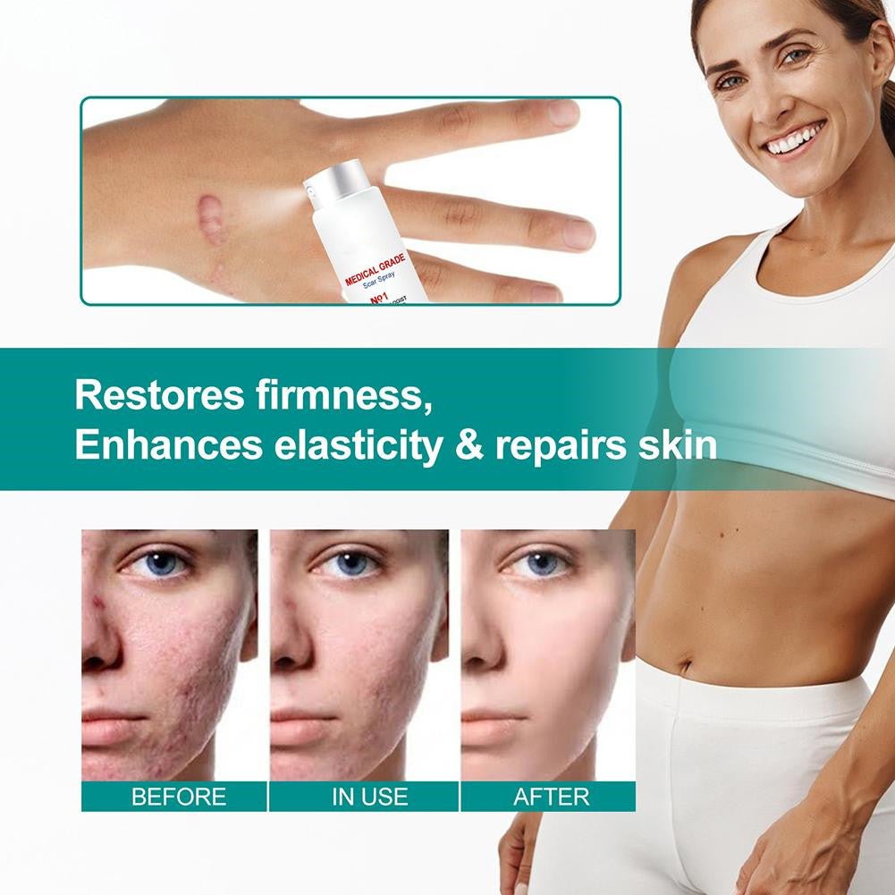 Scar Care Spray Repair Fluid - AmiraMart