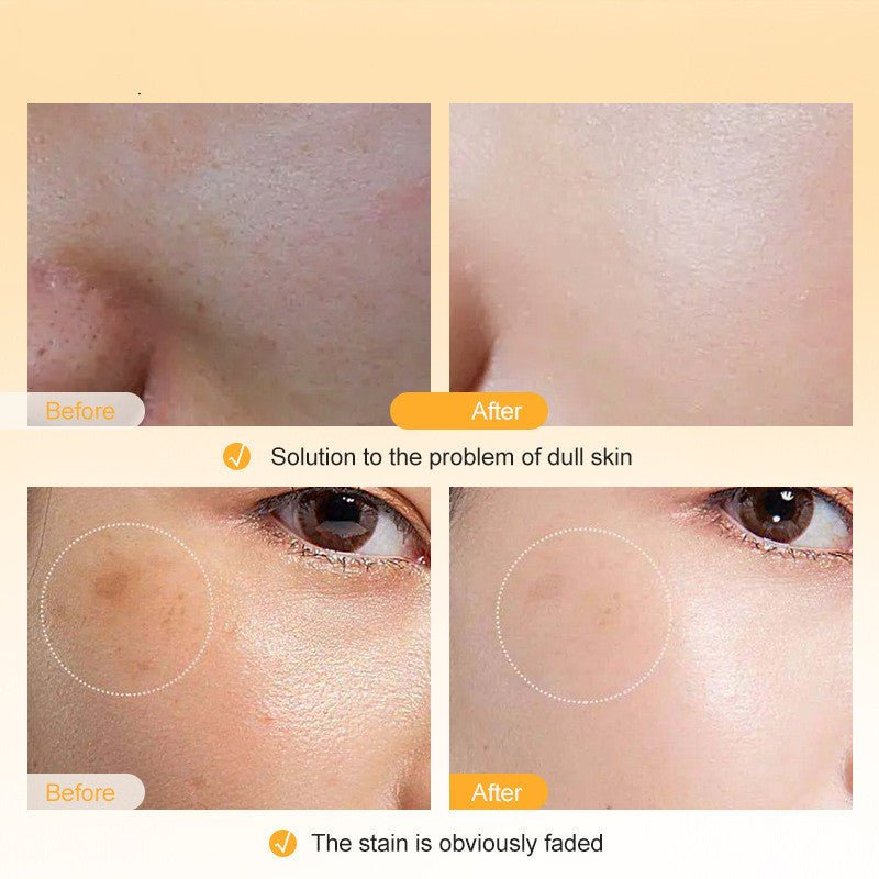 Vitamin C Facial Lotion Skin Care - AmiraMart